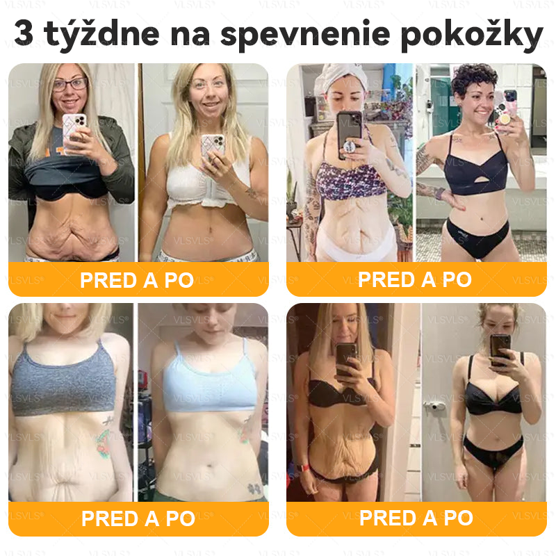 VLSVLS® 🎁🎁🎁Zostáva už len 10 kusov! Ponúkame vám dodatočnú zľavu 50 %! Dajte sa do formy a zlepšite svoje zdravie. Ak to teraz zmeškáte, ďalšia šanca príde až o rok.