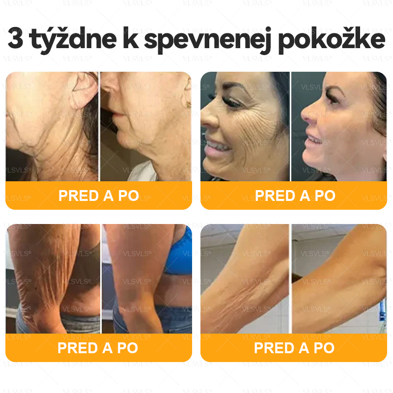 VLSVLS® 🎁🎁🎁Zostáva už len 10 kusov! Ponúkame vám dodatočnú zľavu 50 %! Dajte sa do formy a zlepšite svoje zdravie. Ak to teraz zmeškáte, ďalšia šanca príde až o rok.