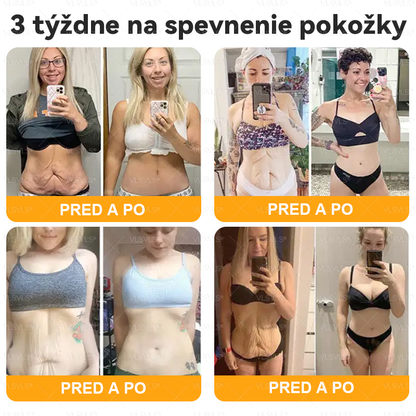 VLSVLS® 🎁🎁🎁Zostáva už len 10 kusov! Ponúkame vám dodatočnú zľavu 50 %! Dajte sa do formy a zlepšite svoje zdravie. Ak to teraz zmeškáte, ďalšia šanca príde až o rok.
