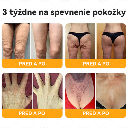 VLSVLS® 🎁🎁🎁Zostáva už len 10 kusov! Ponúkame vám dodatočnú zľavu 50 %! Dajte sa do formy a zlepšite svoje zdravie. Ak to teraz zmeškáte, ďalšia šanca príde až o rok.