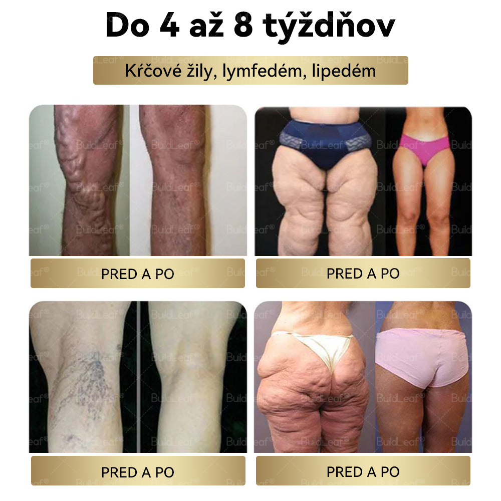 🌸Odporúčané klinikou Mayo | Oficiálny obchod | BuildLeaf® GLP-1 Moringa Slimming & Health Boost Drops🔥 (Spaľovač tukov potravinárskej kvality – vyvinutý Spoločnosťou pre obezitu)