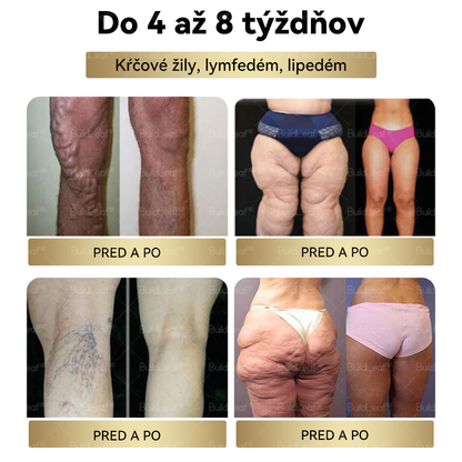 🌸Odporúčané klinikou Mayo | Oficiálny obchod | BuildLeaf® GLP-1 Moringa Slimming & Health Boost Drops🔥 (Spaľovač tukov potravinárskej kvality – vyvinutý Spoločnosťou pre obezitu)